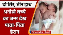 Madhya Pradesh: Ratlam में पैदा हुआ 2 सिर, 3 हाथ वाला अनोखा बच्चा, डॉक्टर्स भी हैरान |वनइंडिया हिंदी
