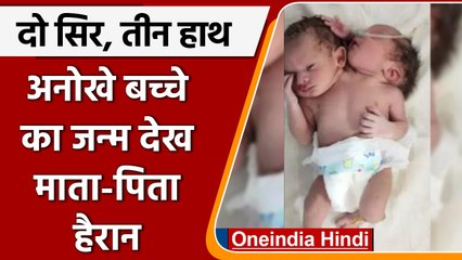 Madhya Pradesh: Ratlam में पैदा हुआ 2 सिर, 3 हाथ वाला अनोखा बच्चा, डॉक्टर्स भी हैरान |वनइंडिया हिंदी