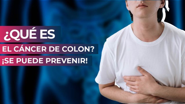¿Qué es el cáncer de colon? ¡Se puede prevenir!