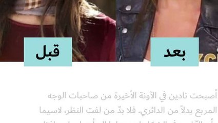 نادين نجيم قبل وبعد عمليات التجميل