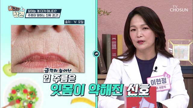 주름으로 찾아내는 건강 적신호 수명 단축의 원인 TV CHOSUN 20220401방송