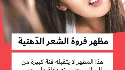 إعتماد تسريحة ذيل الحصان لإخفاء الإفرازات الدهنية