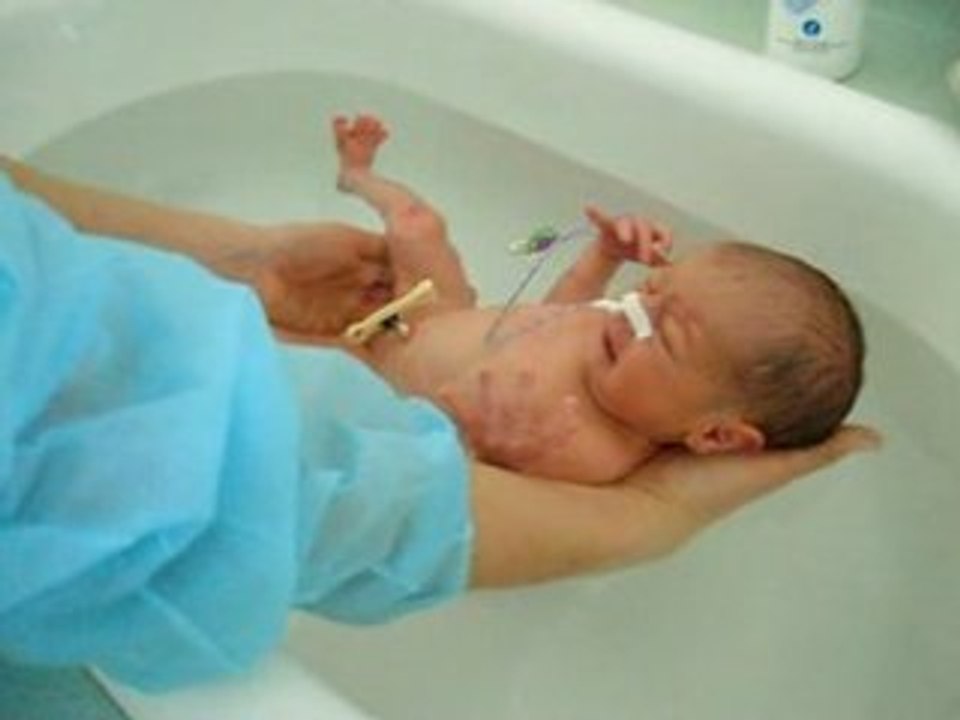 Le premier bain de Noam au service des soins intensifs