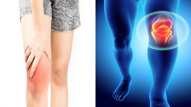 घुटनों में सूजन क्यों आती है | घुटनों में सूजन आने का कारण | Boldsky