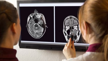 Sang dans les crottes de nez : un trouble qui doit vous alerter