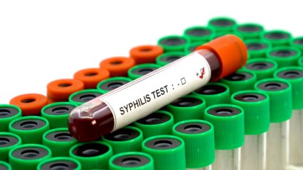 STI: Doctors warn of a spread of ‘extremely drug-resistant’ infection post-pandemic