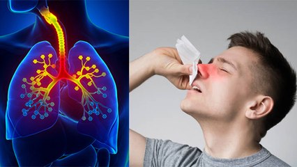 नाक में खुजली होना Allergic Rhinitis Symptoms, क्या है उपाय | Boldsky