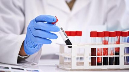 TCK : définition, rôle, comment analyser les résultats ?