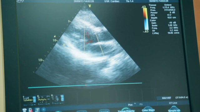 UK government will intervene to ensure abortion services in Northern Ireland