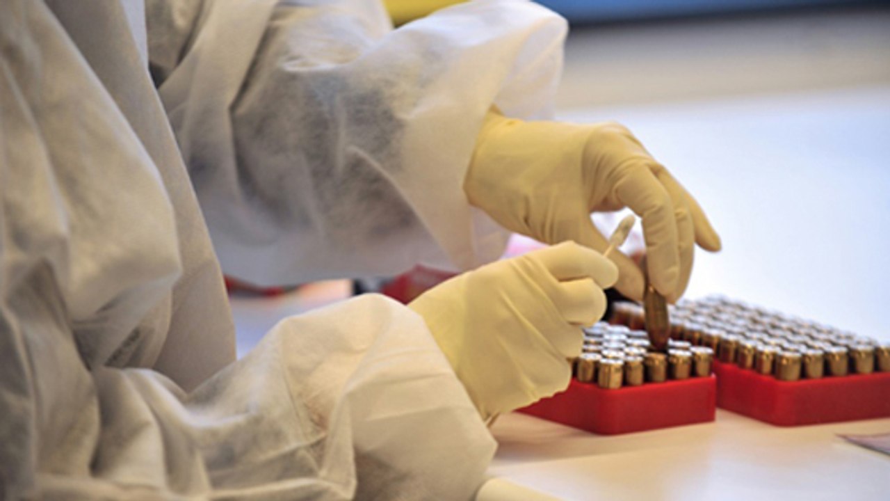 Brustkrebs: Ein Cholesterinderivat soll neue Therapieansätze ermöglichen