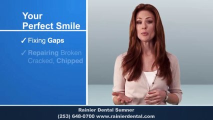 Best Dentist Sumner WA