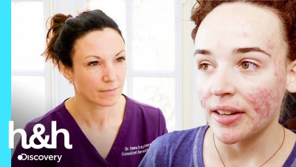 Sufre de un severo acné desde la adolescencia | Clínica de la Piel | Discovery H&H