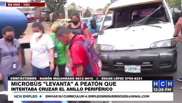 Gravemente herido peatón, tras brutal embestida en el Anillo Periférico