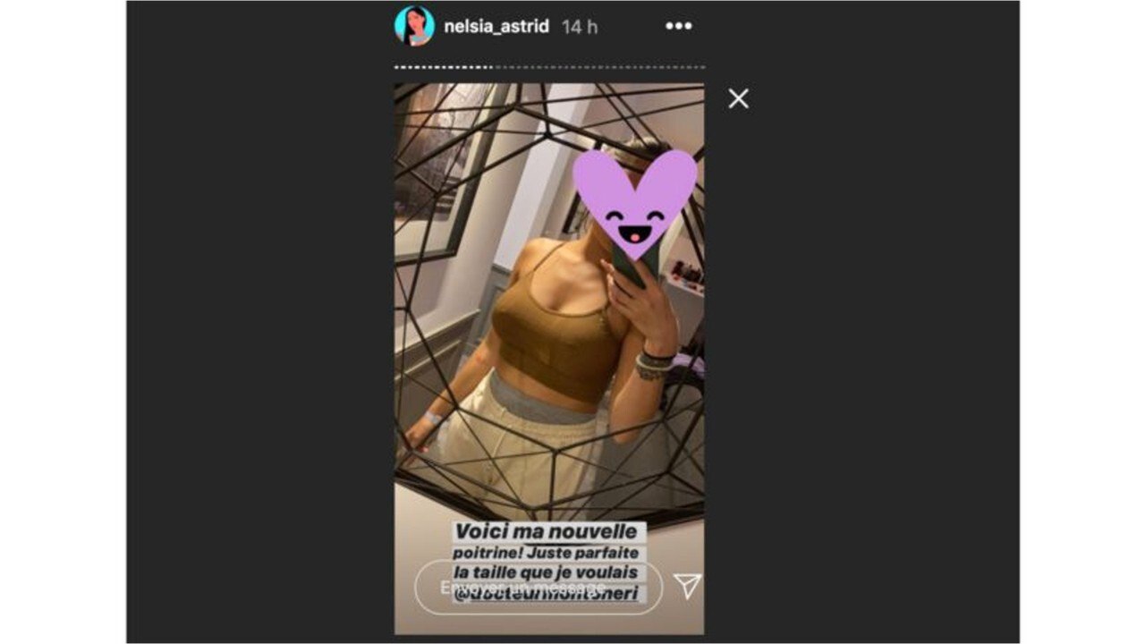 VOICI Astrid Nelsia opérée des seins : des internautes en larmes en découvrant le résultat