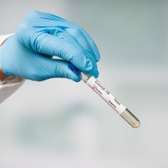 CAM - Symptômes de la Covid : quand se faire dépister ?