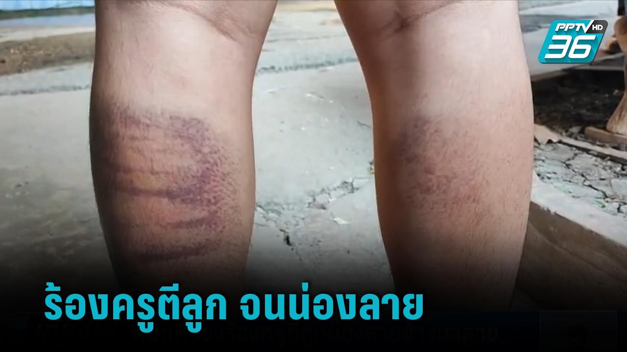 ผู้ปกครอง ร้องลูกชายชั้น ปวส.ถูกครูหวดน่อง 30 ครั้ง อ้างมาสาย | เที่ยงทันข่าว