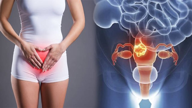 बच्चेदानी में सूजन क्यों होती है | बच्चेदानी में सूजन का कारण और लक्षण | Boldsky