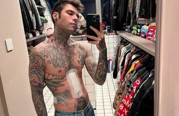 Fedez parla della sua cicatrice dopo l'intervento: Non c'è nulla di brutto!