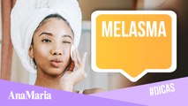 MELASMA: 5 PASSOS QUE VÃO TE AJUDAR NO TRATAMENTO DAS MANCHAS (2022)