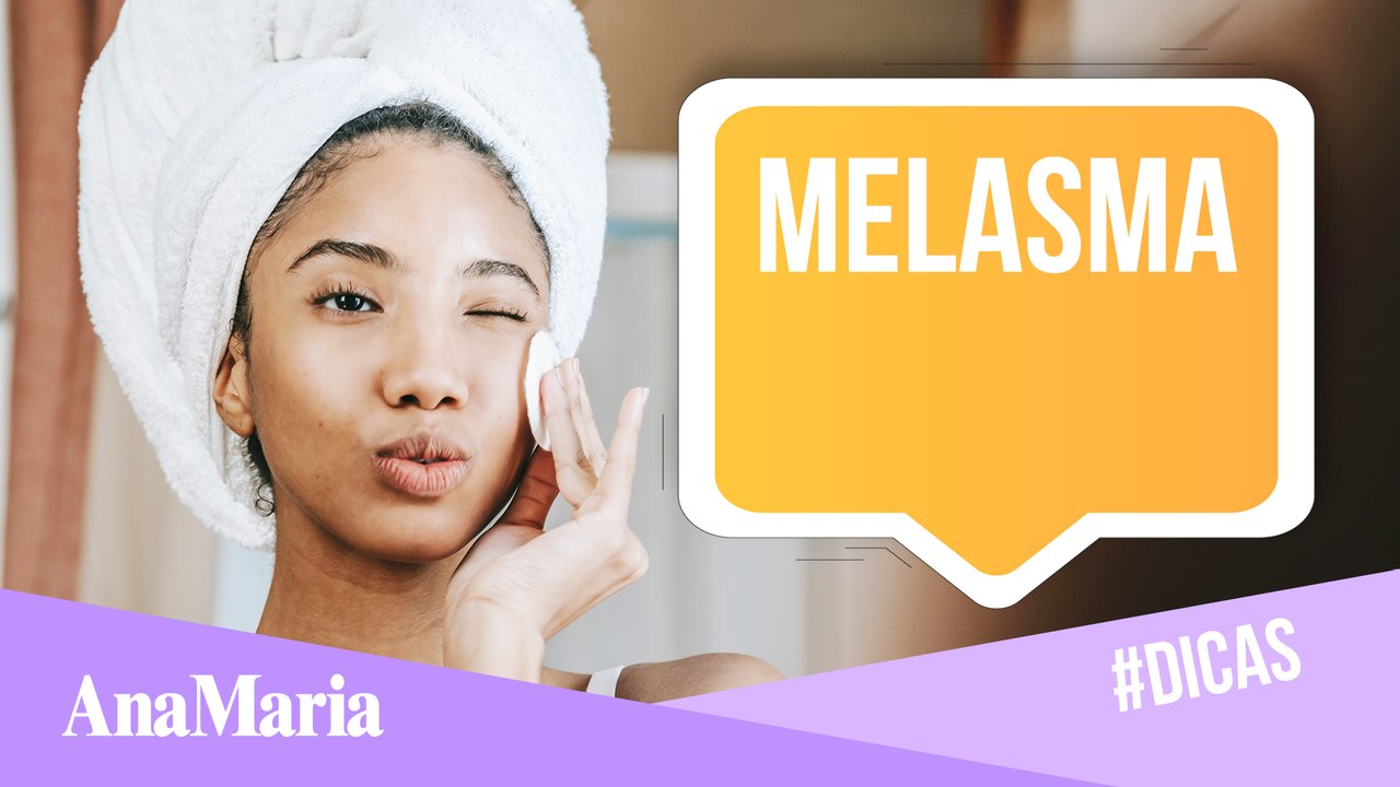 MELASMA: 5 PASSOS QUE VÃO TE AJUDAR NO TRATAMENTO DAS MANCHAS (2022)