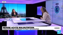 Severe acute malnutrition: A new effective approach to fight the scourge