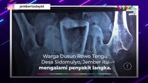 Penampakan Gelas Kaca saat Nyangkut di Perut Warga Jember