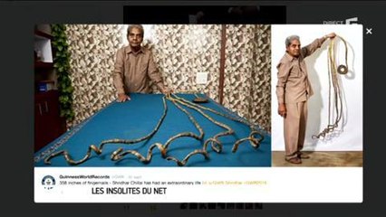 ça fait 62 ans qu'il ne se coupe pas les ongles ! le magazine de la santé (1)