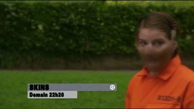 Skins (Direct Star) Bande-annonce 11 juillet