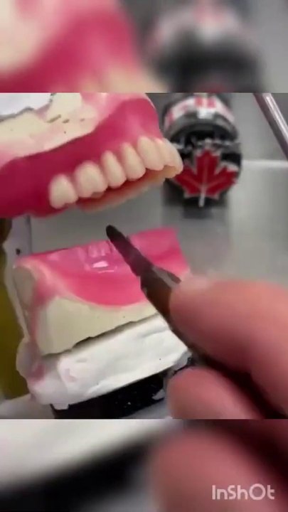 Teeth arrangement