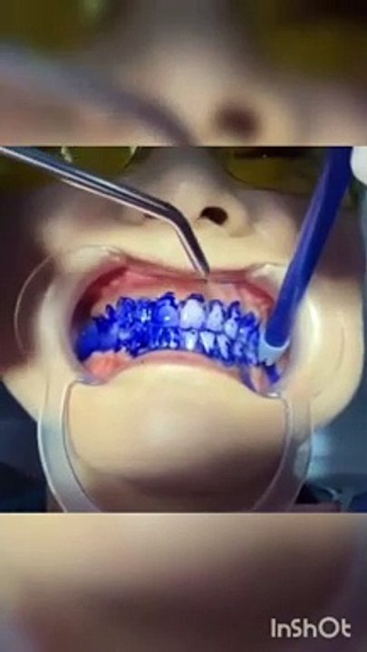 Orthopaedic treatment