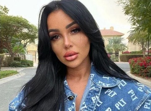 Fidji Ruiz défigurée : mais qu'est-il arrivé au visage de la star de télé-réalité ?