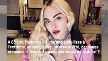 Madonna méconnaissable à 63 ans : ces opérations de chirurgie esthétique qui ont modifié son visage et dont elle refuse de parler