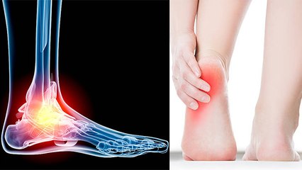 तलवों में दर्द क्यों होता है | तलवों में दर्द का कारण | Boldsky