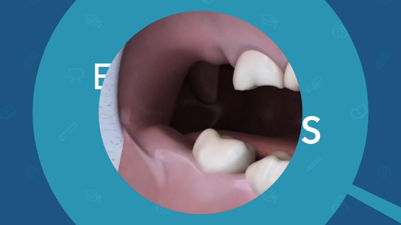Il A La Dent Dure En 6 Lettres Névralgie dentaire (rage de dents) : causes, symptômes, durée et traitement  : Femme Actuelle Le MAG