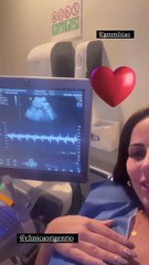 Gravidez de Viviane Araujo: confira novo ultrassom da atriz