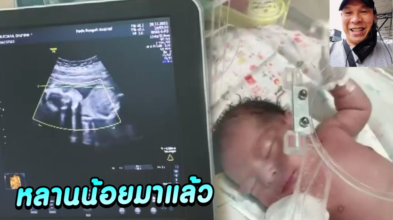 ภาพอัลตราซาวด์ น้องบะหมี่หลาน โหน่ง ชะชะช่า กลา...