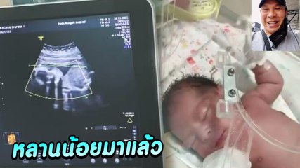 ภาพอัลตราซาวด์ น้องบะหมี่หลาน โหน่ง ชะชะช่า กลายเป็นคุณปู่แล้วว