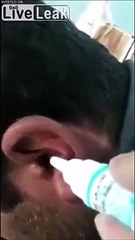 Ce qui sort de son oreille est terrifiant