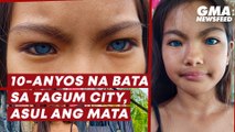 10-anyos na bata sa Tagum City, asul ang mata | GMA News Feed