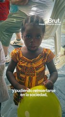 Esta asociación le devuelve la sonrisa a niños desfigurados