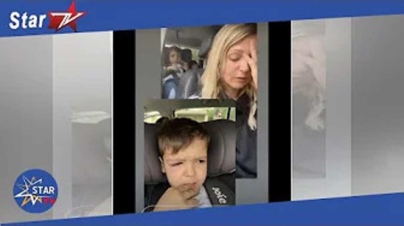 Ambre Dol (Familles nombreuses) : son fils au plus mal, le visage gonflé, photo et explication