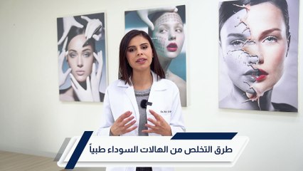 علاج الهالات السوداء