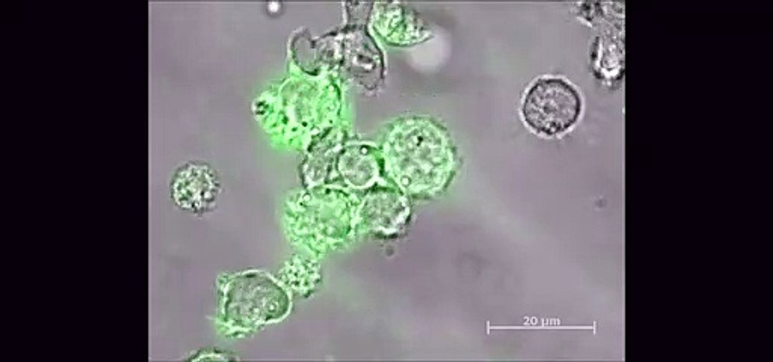 Com um beijo do sono, células cancerígenas colocam células imunes para dormir