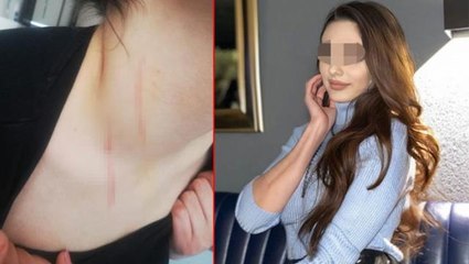 Lüks rezidansa kaçırılan genç kadın yaşadığı dehşeti anlattı: Göğsüme bıçakla imza attılar