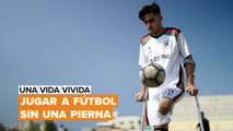 Una vida vivida: jugar a fútbol con solo una pierna