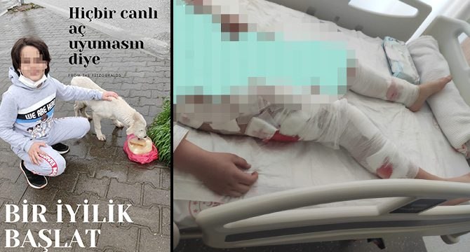 Köpeklerin saldırdığı Ömer Efe, sokak hayvanları projesinde görev almış
