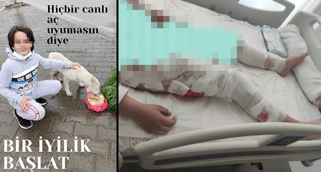 Köpeklerin saldırdığı Ömer Efe, sokak hayvanları projesinde görev almış