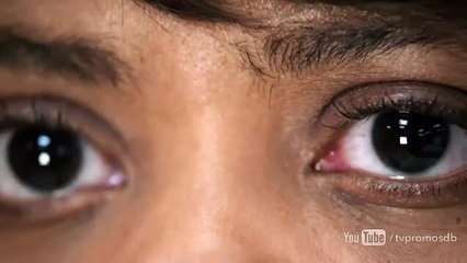 Grey&#039;s Anatomy - saison 14 - épisode 11 Teaser VO