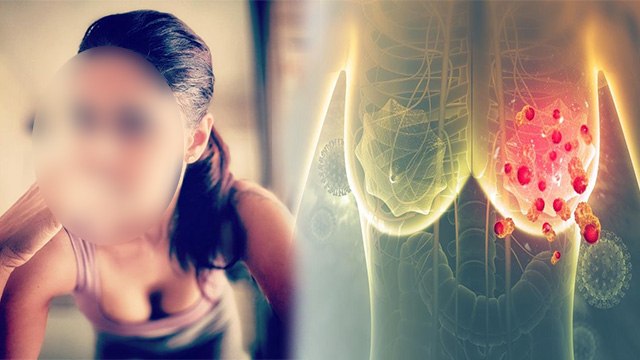 TV Actress Chhavi Mittal को Breast Cancer, Symptoms के साथ Emotional Post Viral | Boldsky