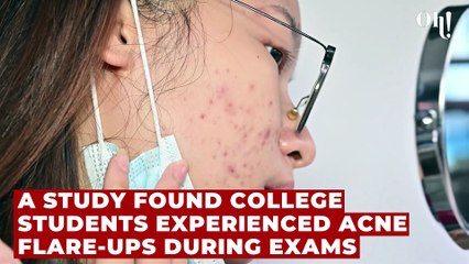 Four physical effects of stress on the body